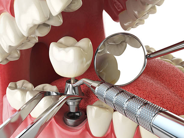 Best Emergency Orthodontic Repairs in Lake Holm, WA